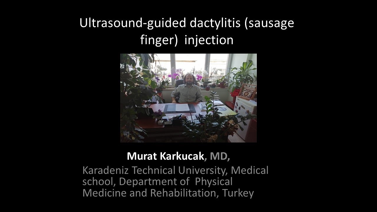 Ultrasound-guided dactylitis (sausage finger)  injection, by Prof Murat Karkucak MD