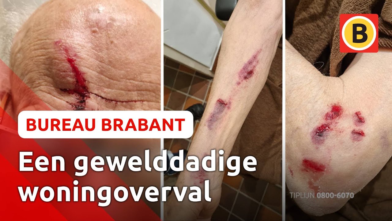 Oude man op BRUTE WIJZE toegetakeld door OVERVALLERS | Bureau Brabant
