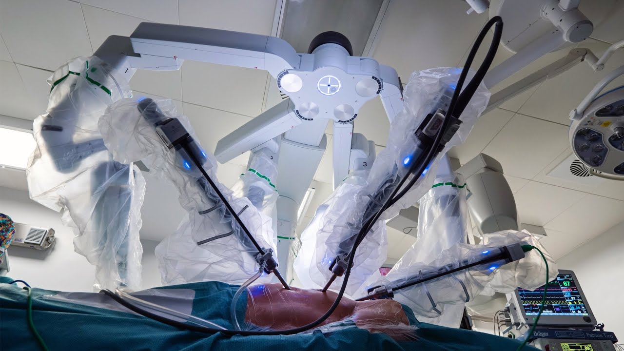 Klinika Kardiochirurgii WIM korzysta z najnowocześniejszego systemu robotycznego DaVinci.