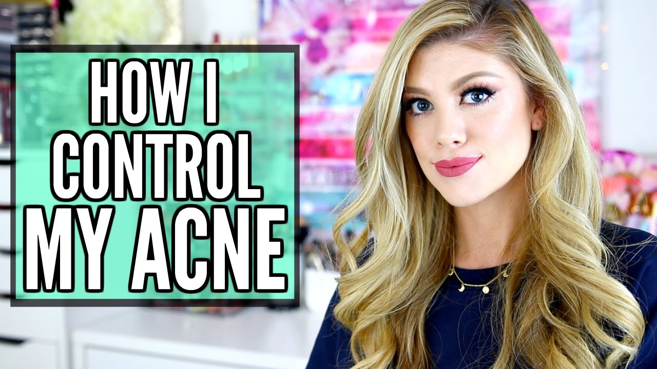 HOW I CONTROL MY ACNE