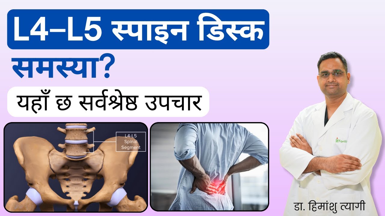 L4–L5 स्पाइन डिस्क समस्या? यहाँ छ सर्वश्रेष्ठ उपचार | L4-L5 Spine Disc problem? in Nepali