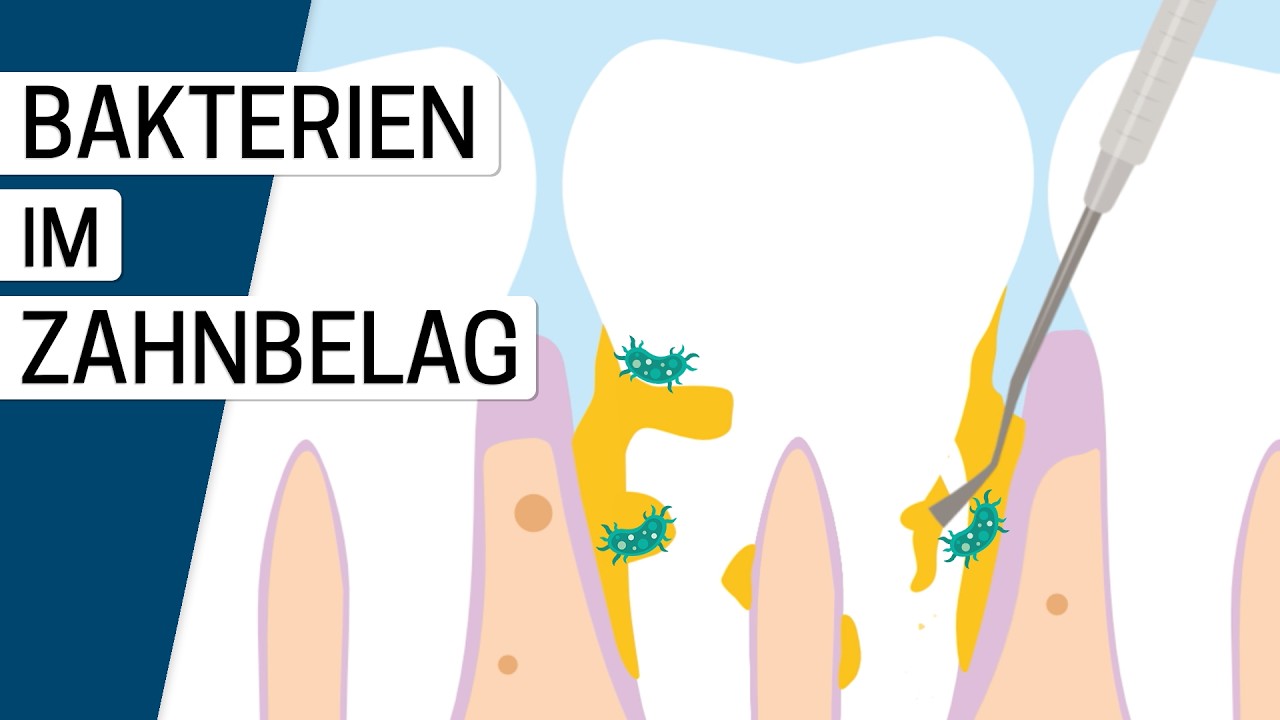 Behandlung von Parodontitis