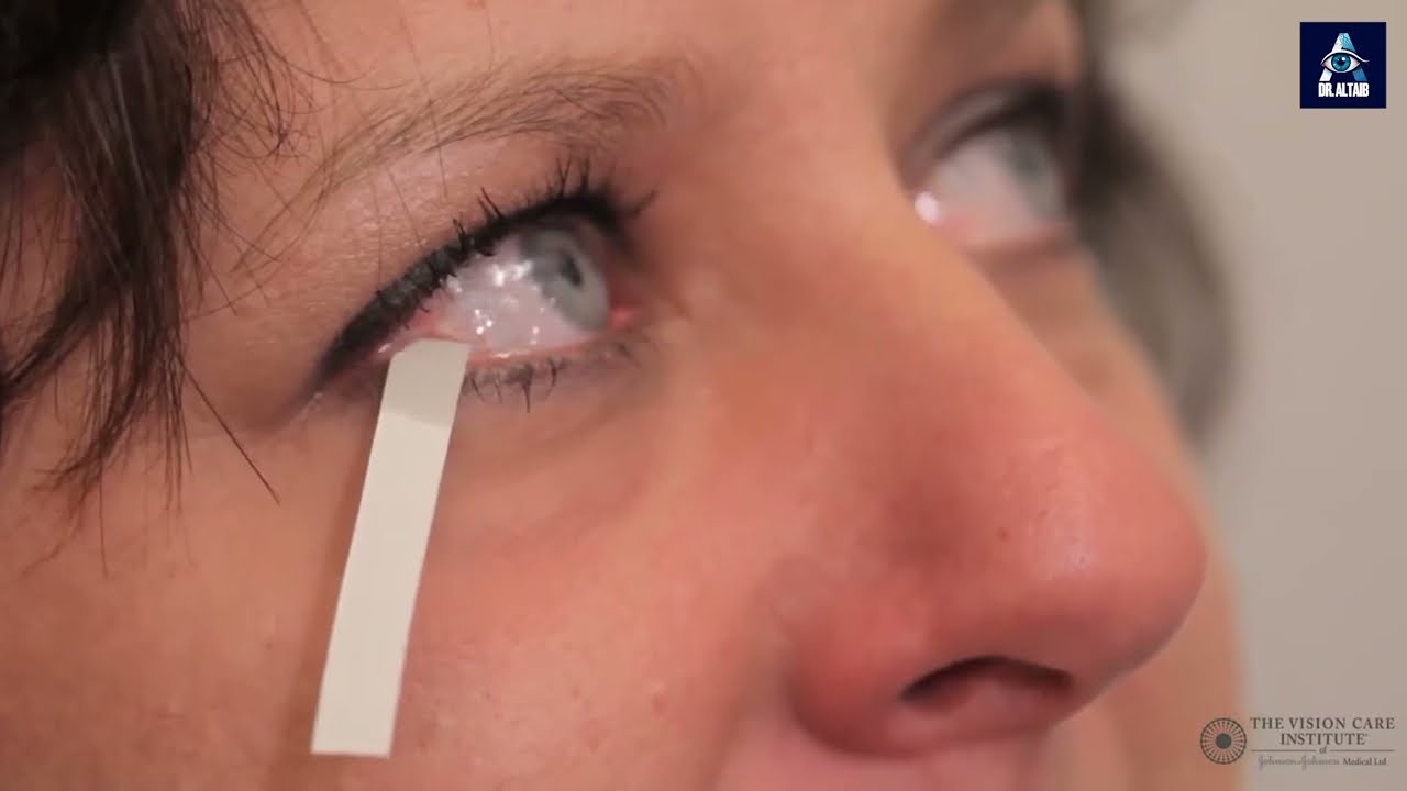 Dry Eye