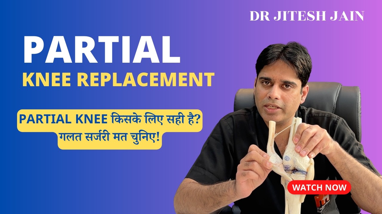 Partial vs Total Knee Replacement: Is it right for you? Explained in Hindi