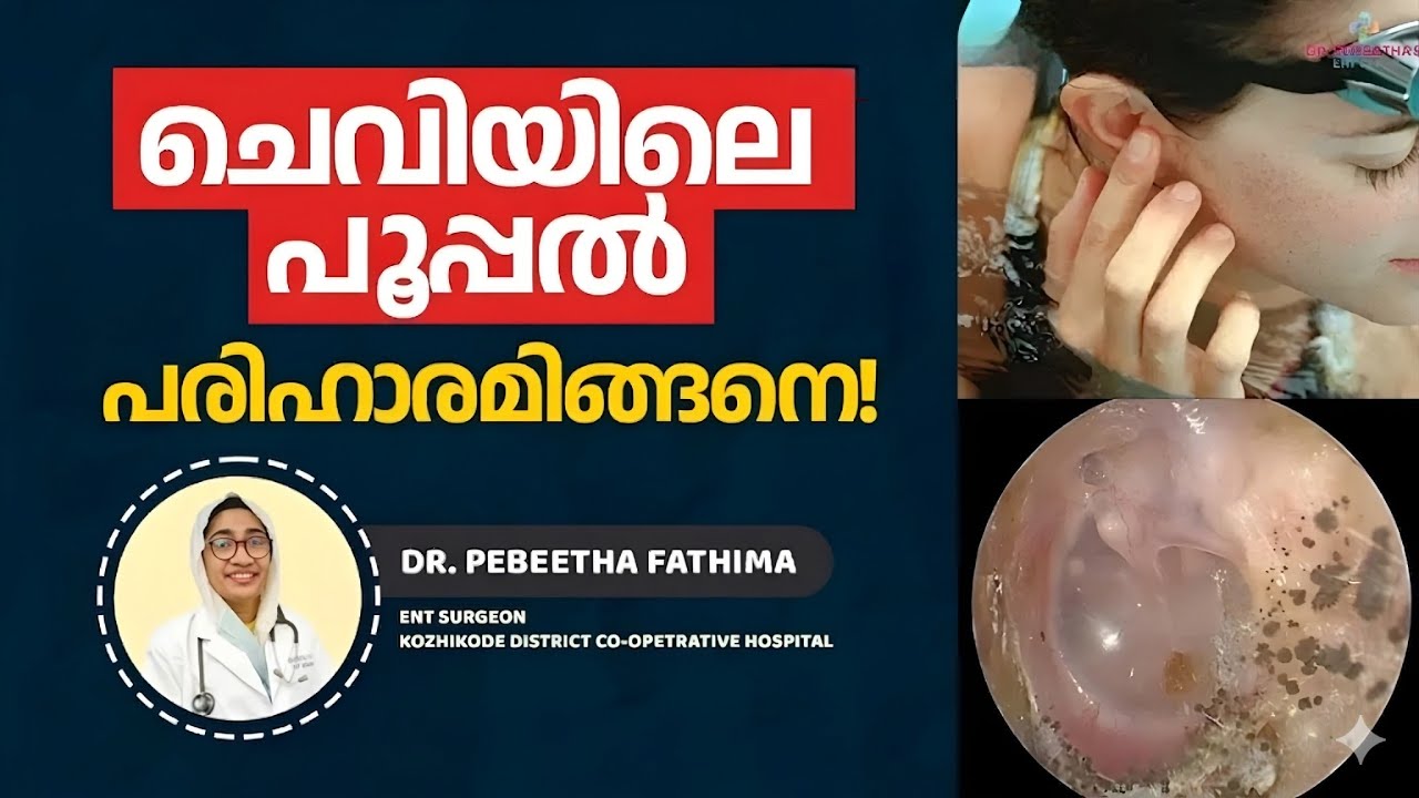 ചെവിയിലെ പൂപ്പൽ. ശാശ്വത പരിഹാരം! Itchy Ear? Know about Otomycosis.