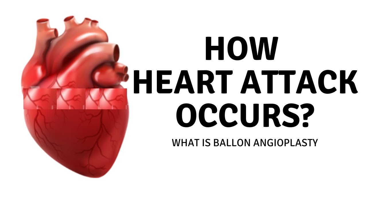 Heart Attack: Prevention, Symptoms, Treatment | Myocardial Infraction