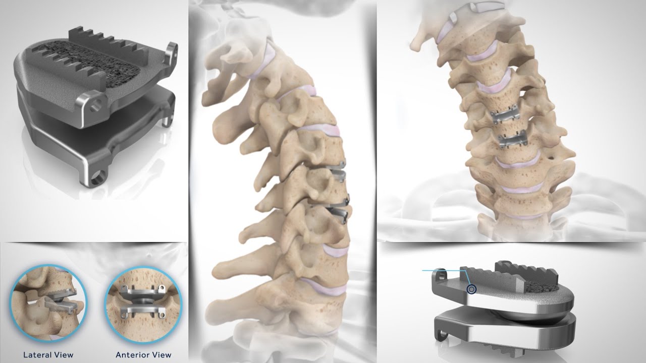 Spine – Pulse 3D Media Spine Reel 2025