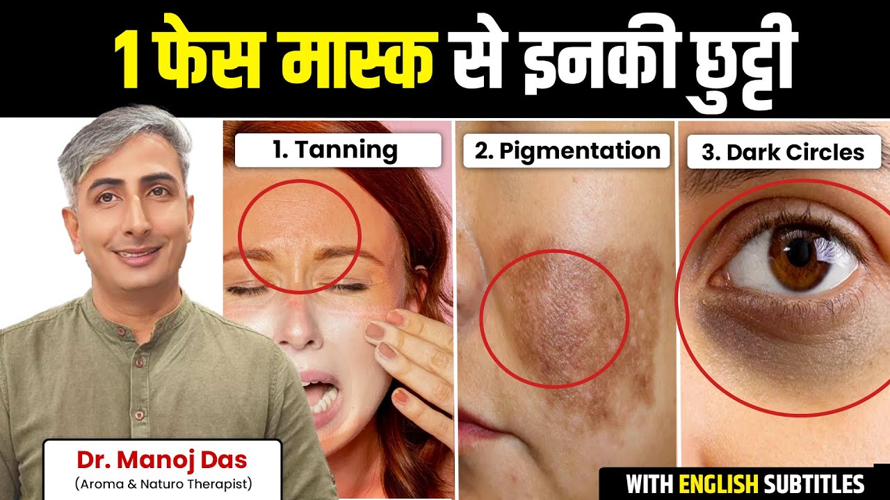 Pigmentation, Dark Spot, Tanning- इस Remedy से होगा 100% इलाज | Dr. Manoj Das