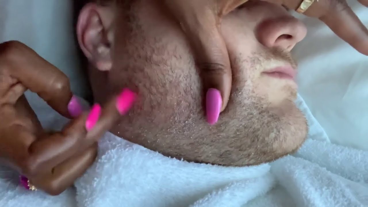 Scratch my Beard in the Sun Room (Dandruff Scratch ASMR)