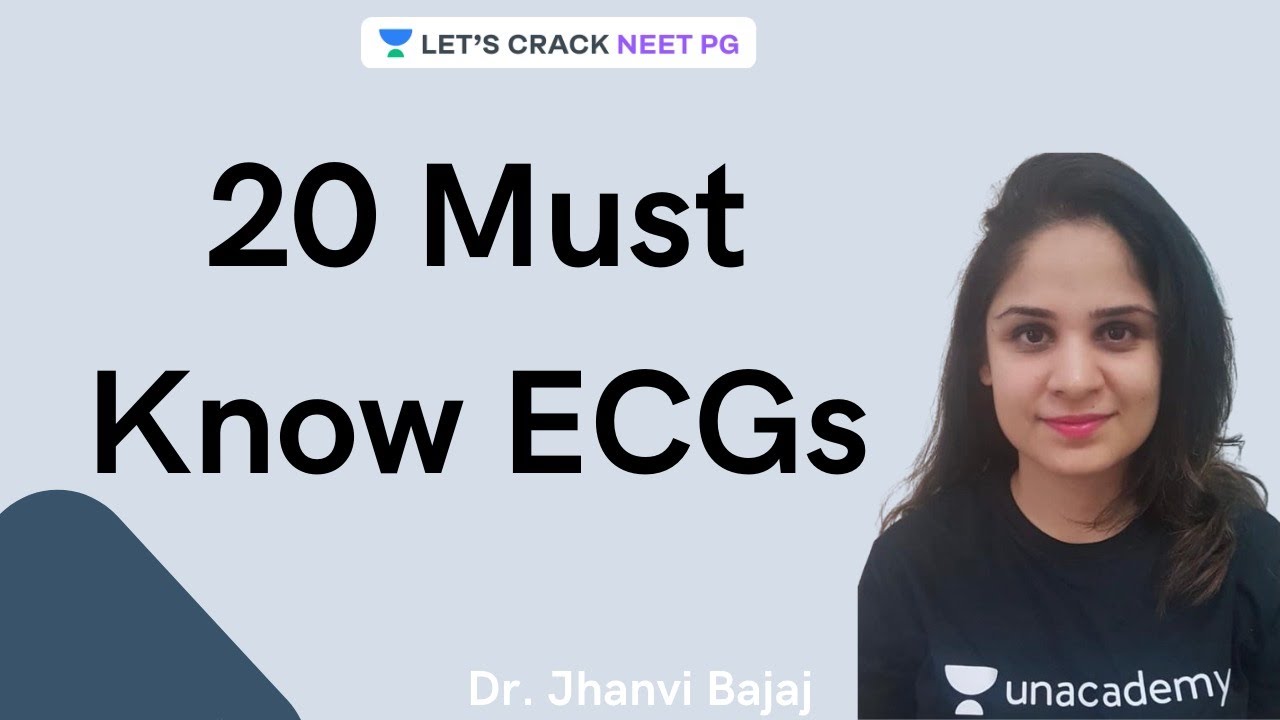 20 Must know ECGs | NEET PG 2021 | Dr. Jhanvi Bajaj