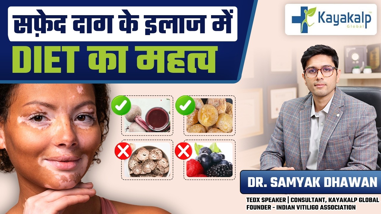 इन सर्दियों करें अपना सफ़ेद दाग ठीक | Winter Diet Chart for Vitiligo Recovery | Kayakalp Global