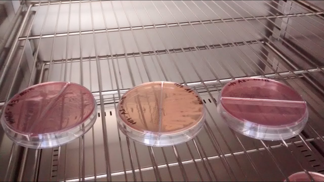 Preparo de Meio de Cultura, Coleta e Semeadura de amostras.
