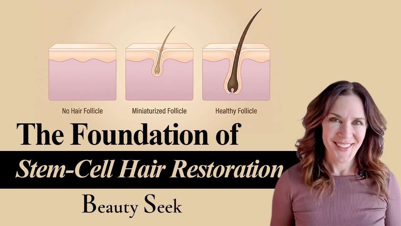 Stem Cell Hair Restoration | Episode 1: Follicles Matter