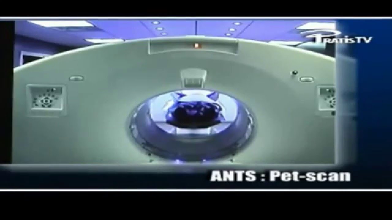 TEP Scanner   Petscan