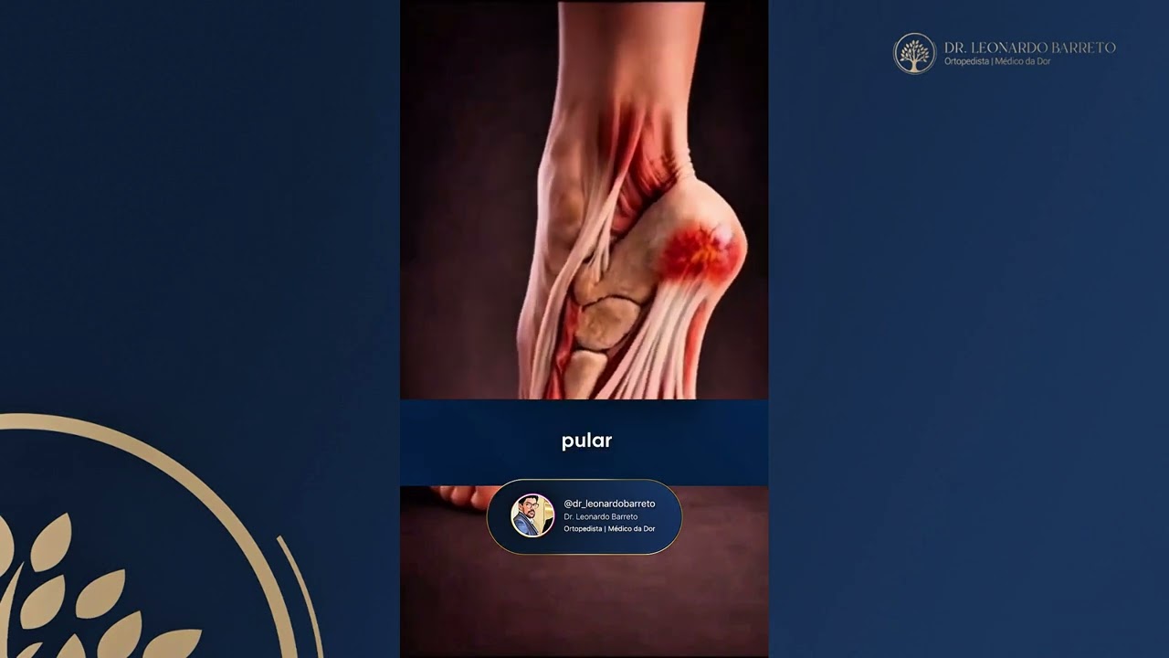 5 hábitos que pioram a fascite plantar 