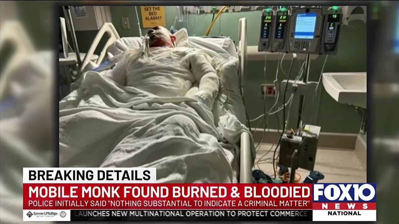 Mystery surrounding Mobile Buddhist monk who was found burned and bloody