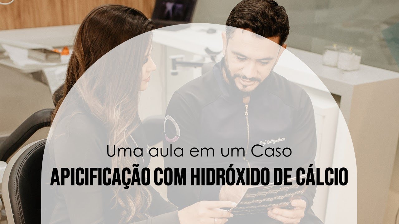 Uma Aula em Um Caso - Tratamento de rizogênese incompleta: apicificação com hidróxido de cálcio