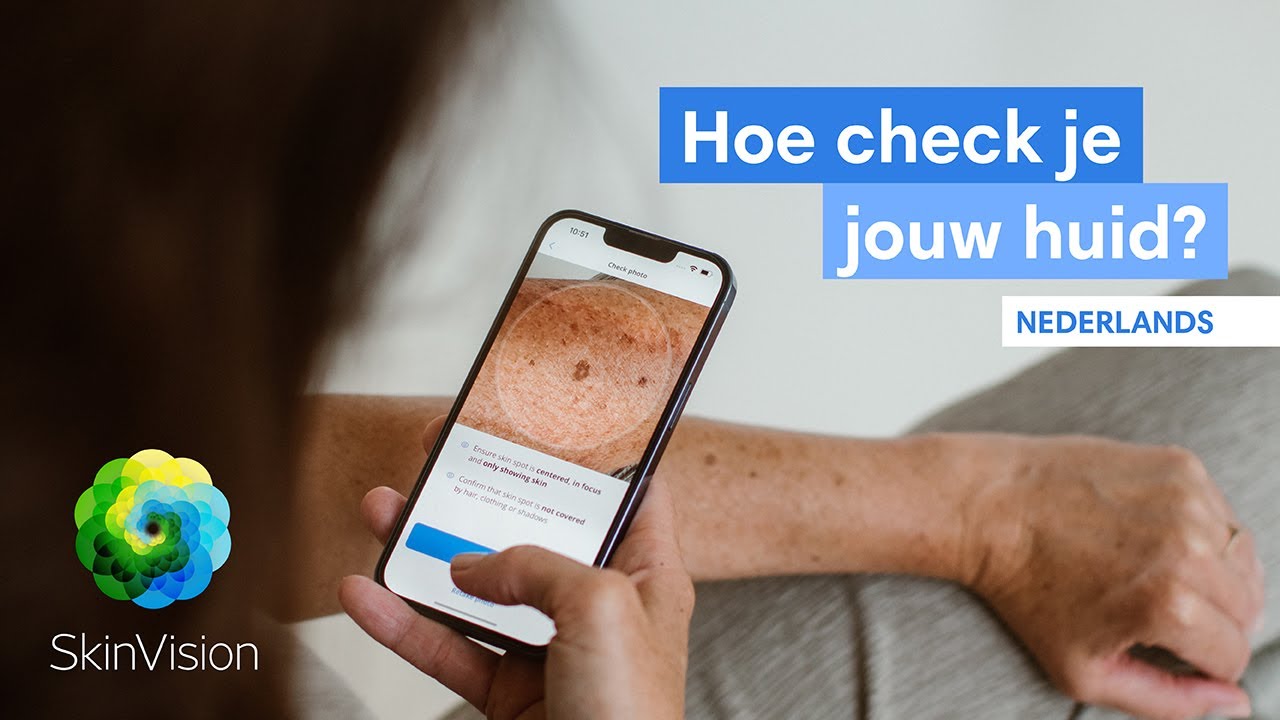 Je huid checken op het risico op huidkanker? Zo doe je dat!