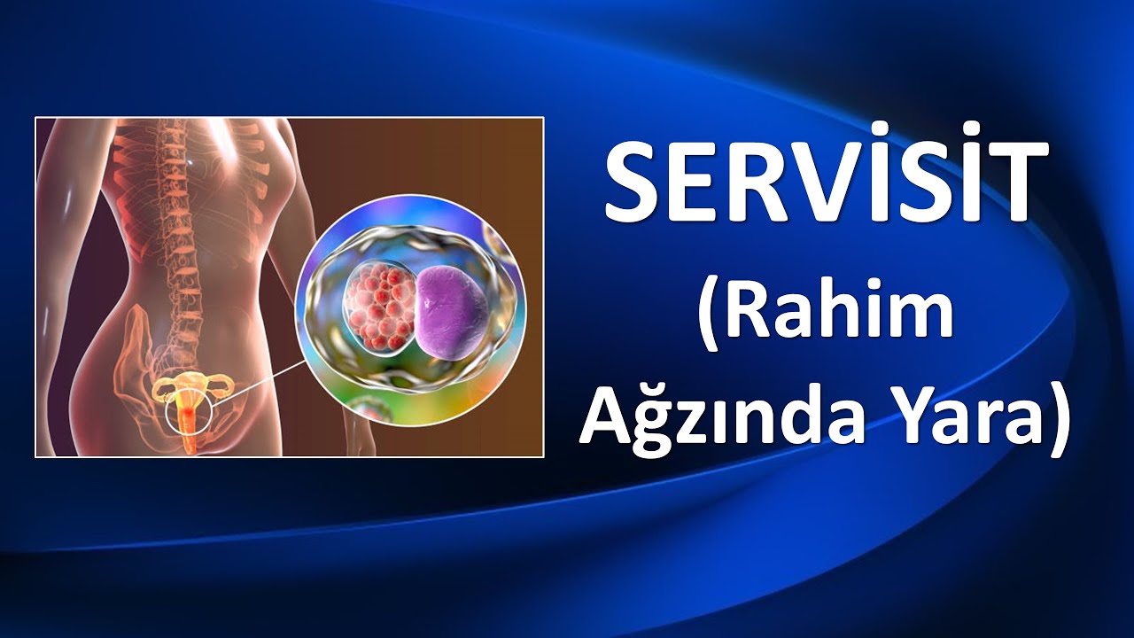 SERVİSİT/ RAHİM AĞZINDA YARA
