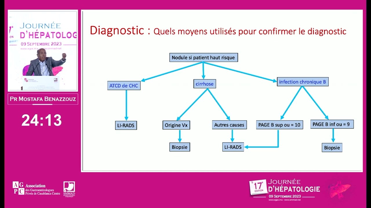 PEC du Carcinome hépatocellulaire AASLD 2023  Pr Mostafa Benazzouz