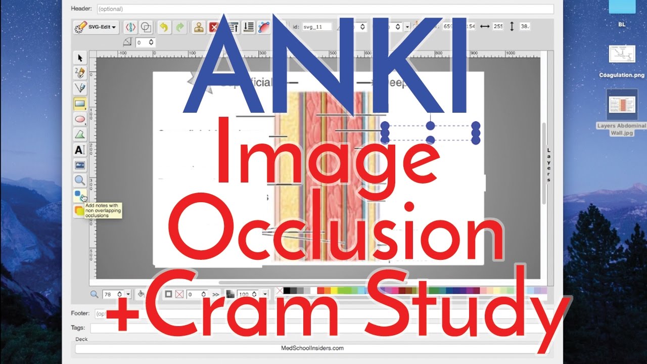 How to Use Anki Effectively - Image Occlusion 2.0 and Cram Studying [Part 2]
