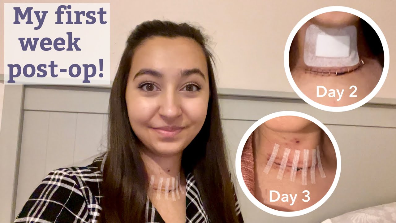 Thyroid Surgery Recovery vlog! | Day 2, 3, 4 & 6 Post-op | week 1