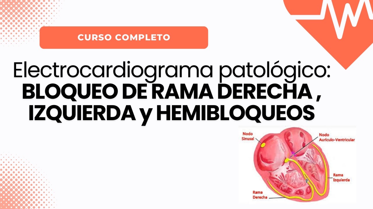 Electrocardiograma Patológico: BLOQUEOS DE RAMA TODO LO QUE DEBES SABER