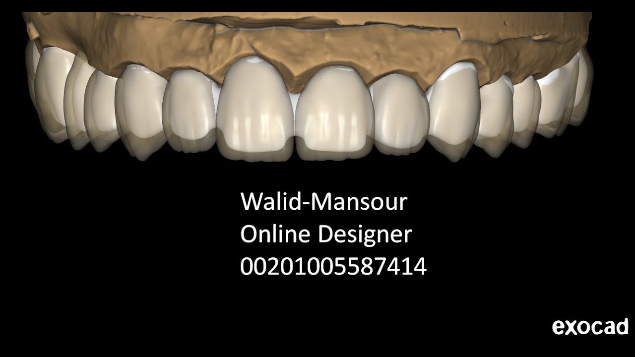 exocad with Walid Mansour 00201005587414 Egypt/Cairo