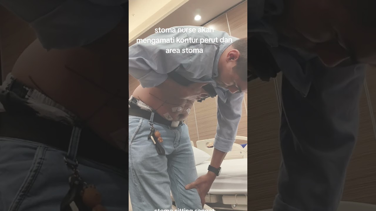 stoma sitting pada pasien stom#ostomy #ostomate #ostomybag #nurse #kankerusus # #trending #viral