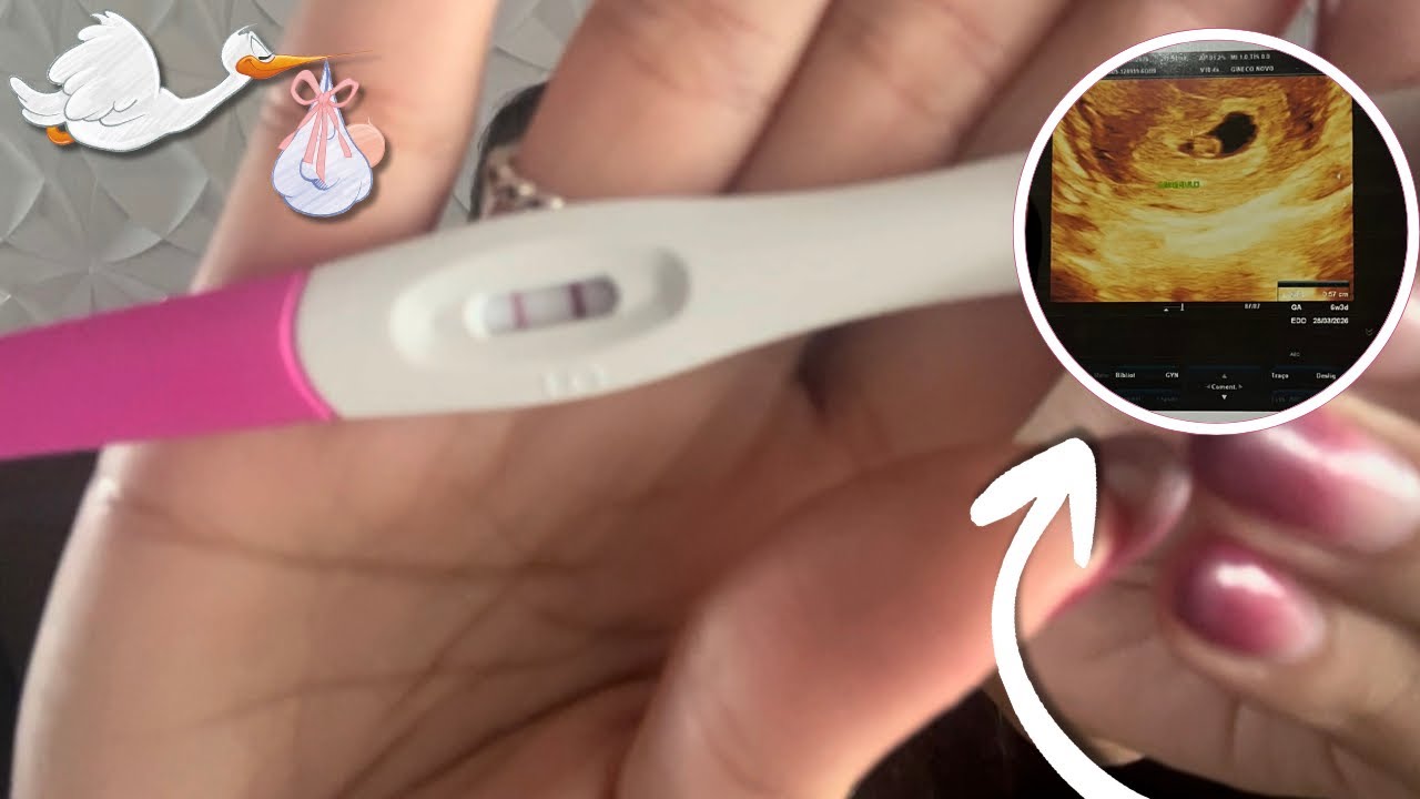 ESTOU GRÁVIDA 🤰🏻 | PRIMEIROS SINTOMAS | COMO DESCOBRI A GRAVIDEZ | DIÁRIO DA GRÁVIDA PARTE 1