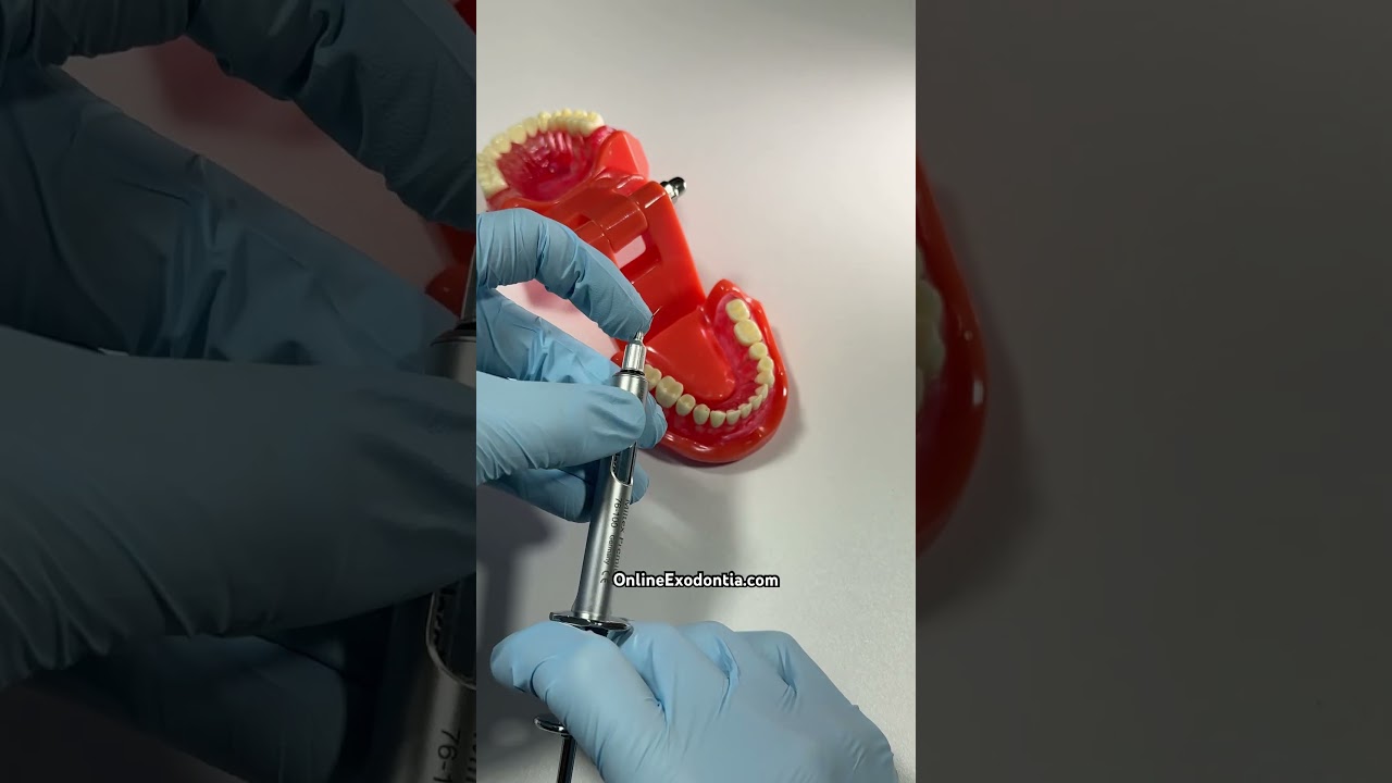 🔥 Extracting Hot or Infected Teeth | OnlineExodontia.com | #dentist #dentistry #dentaltips