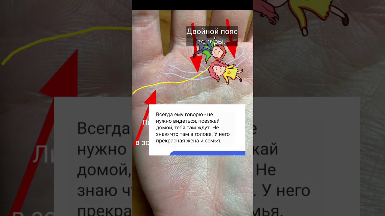Я не замужем, но.. #хирология
