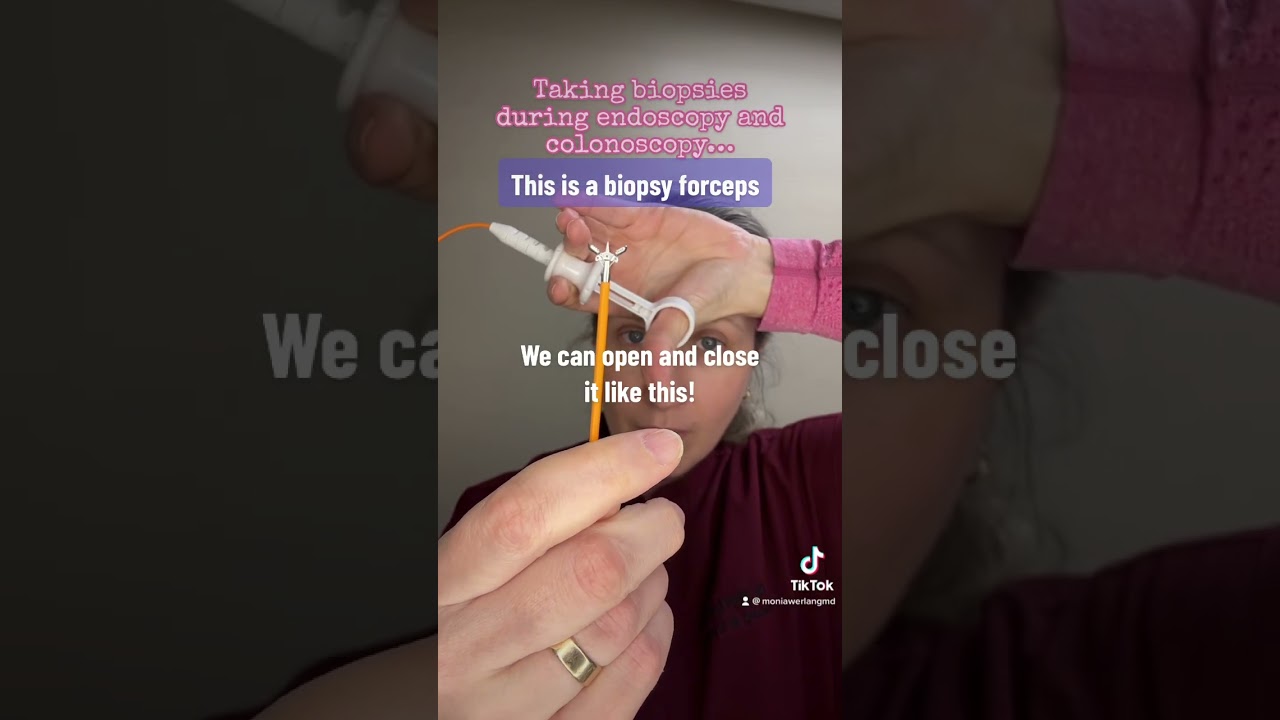 How do we get biopsies? #endoscopy #colonoscopy