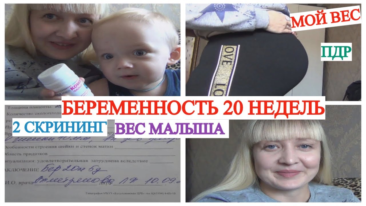 БЕРЕМЕННОСТЬ 20 НЕДЕЛЬ🤰 БОЛЬШОЕ УЗИ👶 О МОЕЙ ЭПИЛЕПСИИ И ОПУХОЛИ🚑 ДАТА РОДОВ