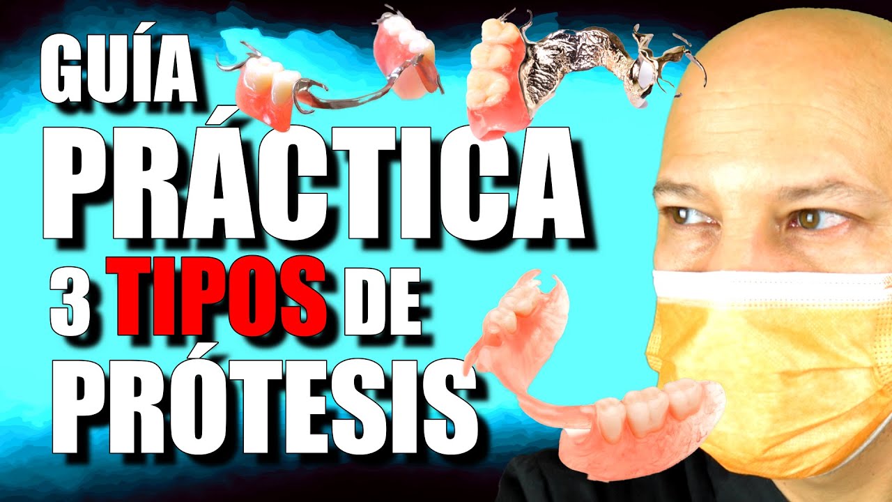 TIPOS de PRÓTESIS REMOVIBLES (comparativa)