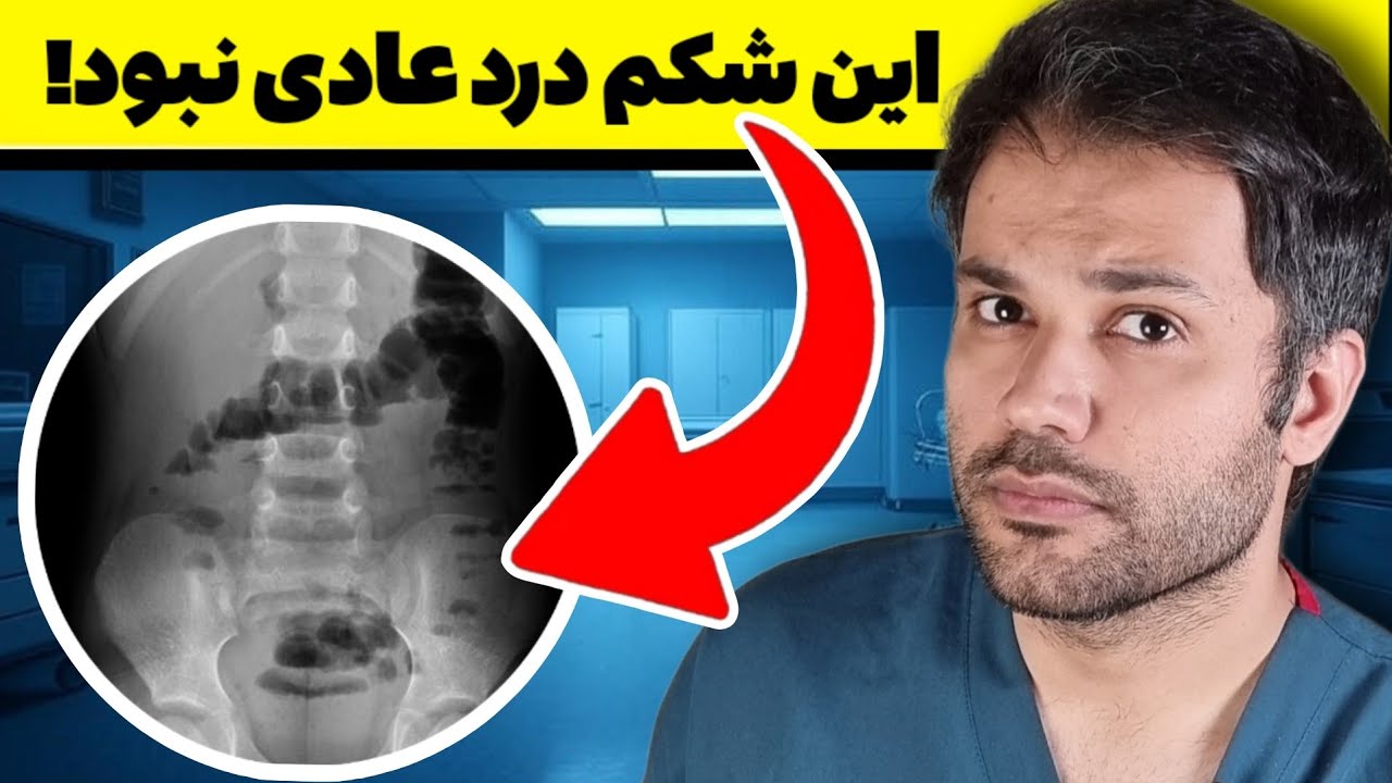 اگر این درد رو داری شاید آپاندیسیت باشه | 10 علامت مهم!