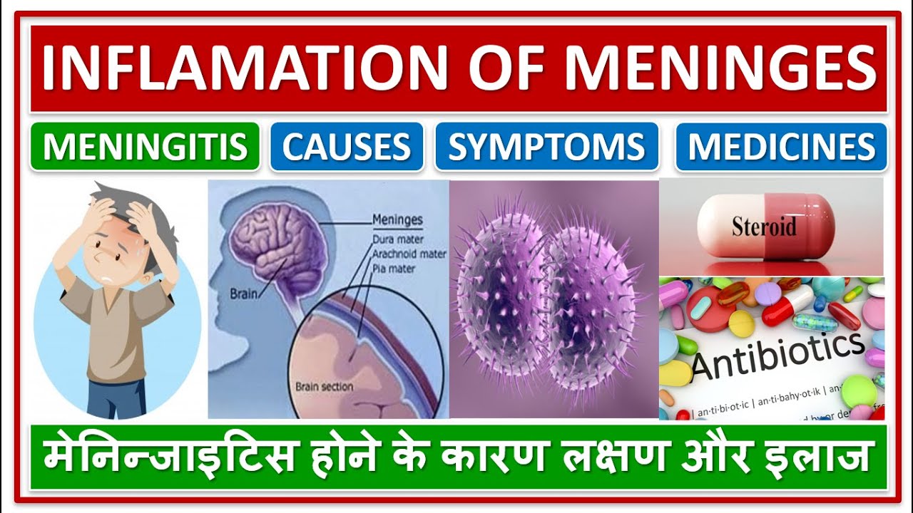 MENINGITIS, INFLAMATION OF MENINGES OF BRAIN, TREATMENT, मेनिन्जाइटिस होने के कारण लक्षण और इलाज