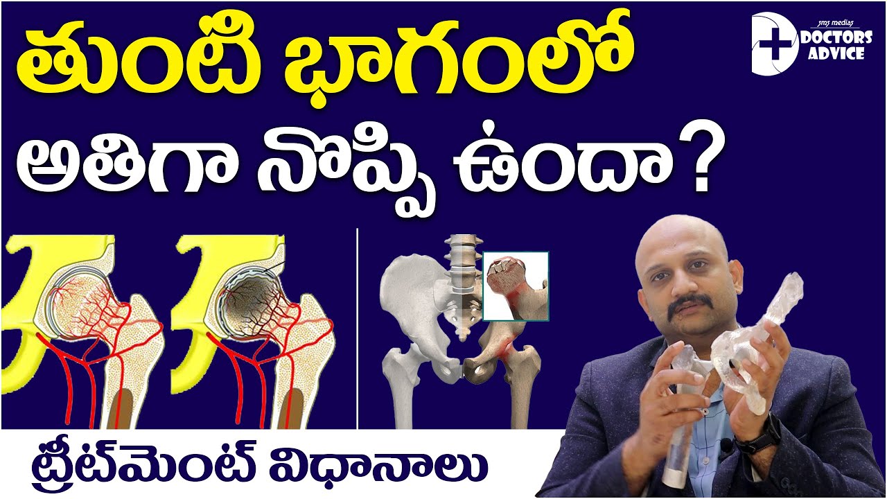 Avascular Necrosis (AVN) Hip Replacement Surgery in Telegu| Hip pain |తుంటి నొప్పి చికిత్స విధానాలు