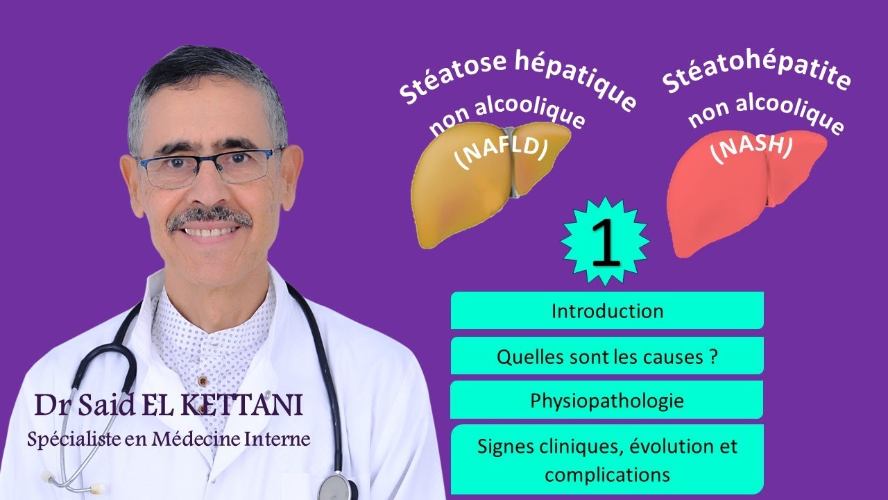 Stéatose hépatique, stéatohépatite non alcoolique, Causes, Signes cliniques évolution, complications