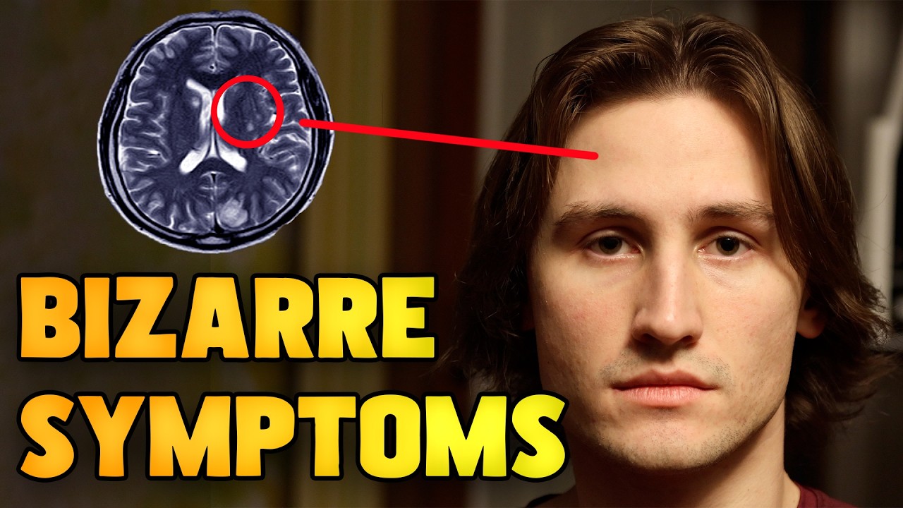 I Got a Rare Tick-Borne Illness | Rocky Mountain Spotted Fever