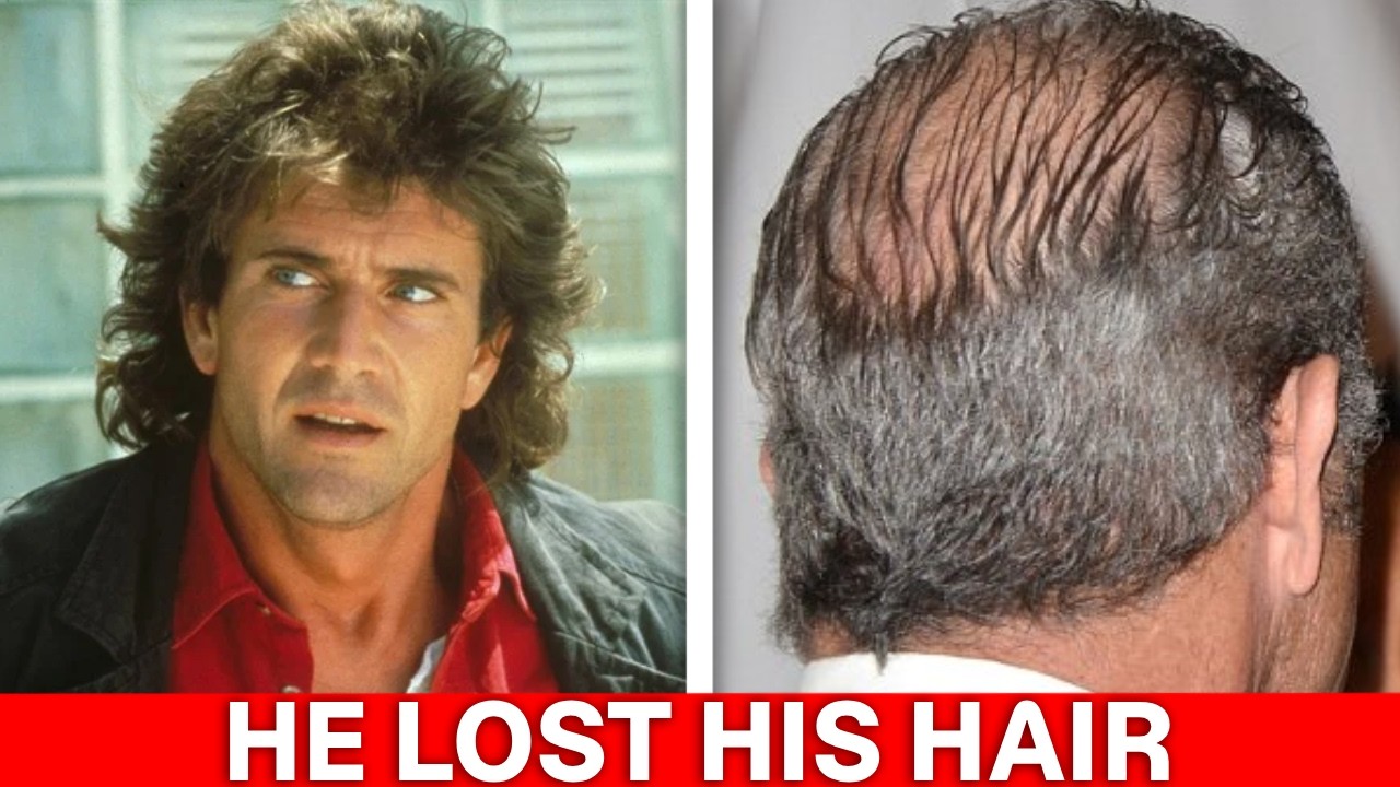Where Did the Hair Go? 13 Hollywood Legends Who Hid Their Baldness