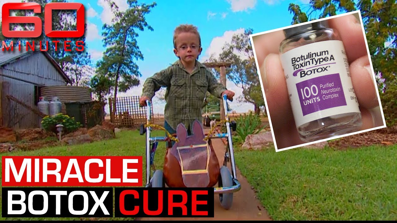 The 'miracle' Botox cure helping the disabled walk again | 60 Minutes Australia