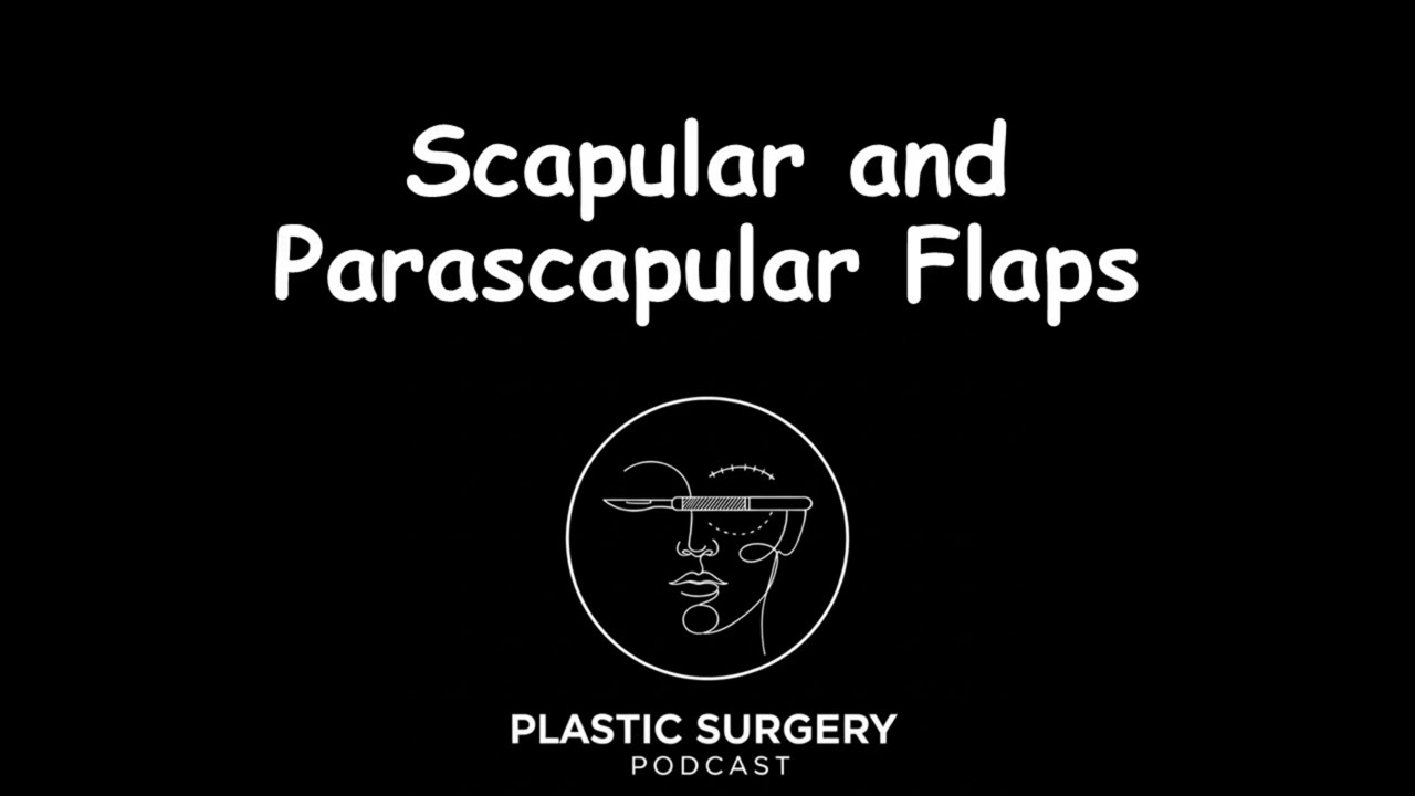 Scapular and Parascapular Flaps Podcast