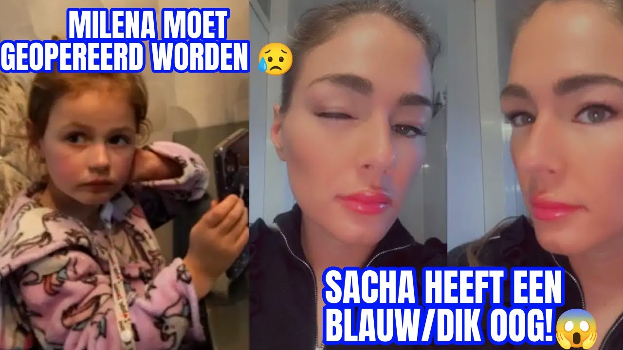 MILENA MOET HIERAAN GEOPEREERD WORDEN😢 & SACHA HEEFT HIERDOOR EEN DIK OOG 😱😳 // VLOG #228