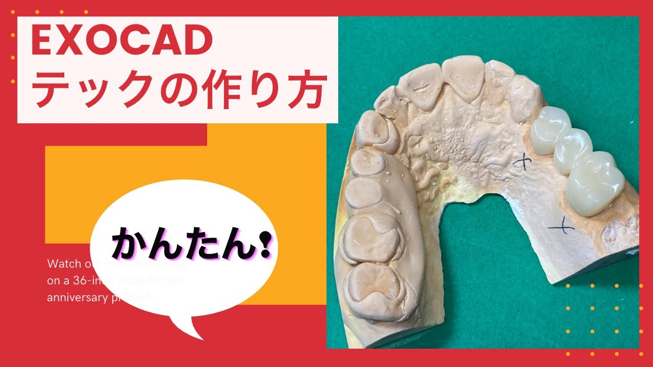 【歯科技工】exocadを使ったテック（仮歯）の作り方