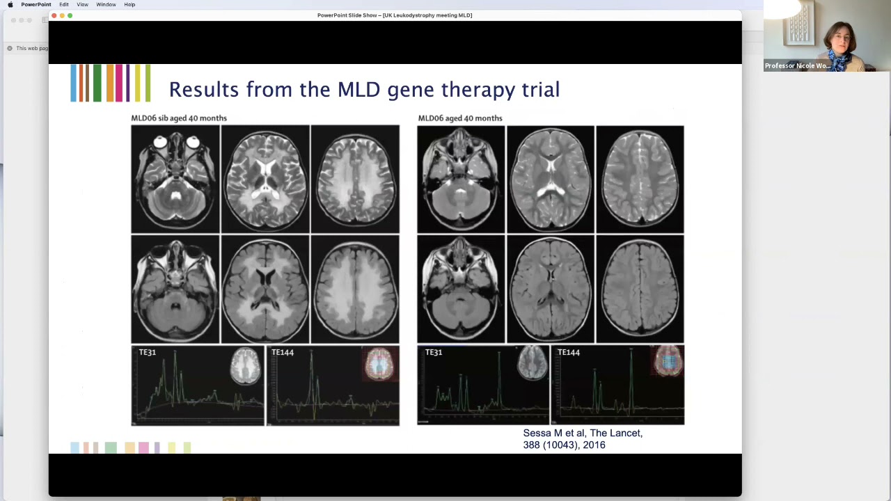 Metachromatic Leukodystrophy MLD Update &ndash; Prof Nicole Wolf