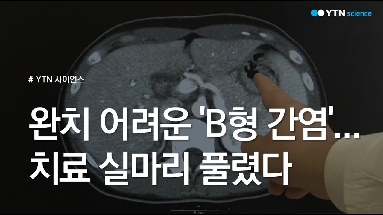 완치 어려운 'B형 간염'...치료 실마리 풀렸다 / YTN 사이언스