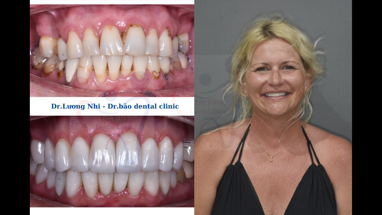 We can travel around during dental vacation dental treatment in Da Nang City