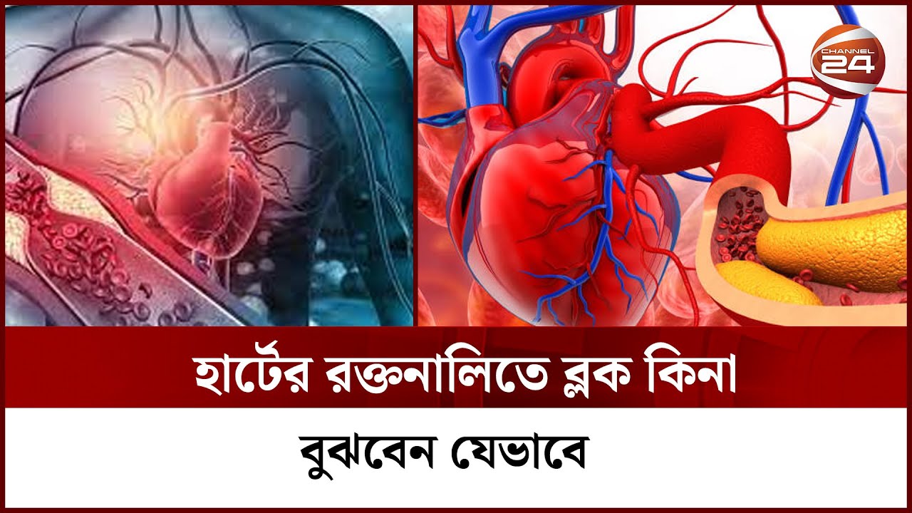 হার্টের রক্তনালিতে ব্লক কিনা বুঝবেন যেভাবে | Channel 24
