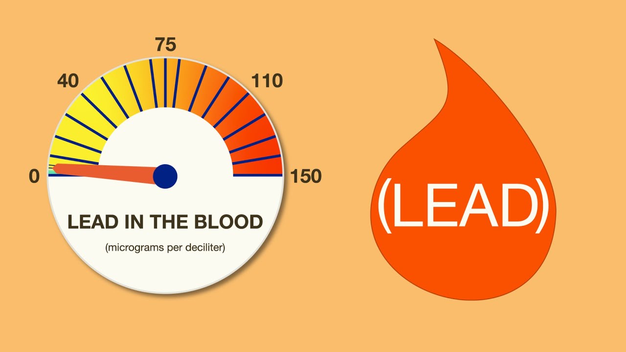 What to Do If You&rsquo;re Worried about Lead Exposure | AAP